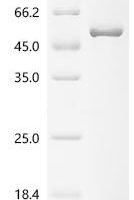 Human Cartilage-associated protein (CRTAP) Recombinant Protein - BioCrest Sci