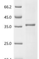 Human Kallikrein-2 (KLK2) Recombinant Protein, N-His/C-His - BioCrest Sci