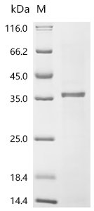 Human Kallikrein-2 (KLK2) Recombinant Protein, N-His/C-His, Homo sapiens (Human), E.coli, N-terminal 6xHis-tagged and C-terminal 6xHis-tagged, 36.2 kDa, purity >≥ 85% as determined by SDS-PAGE.
