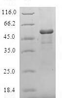 Human Maleylacetoacetate isomerase (GSTZ1) Recombinant Protein - BioCrest Sci