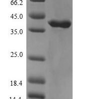 Human Muscarinic acetylcholine receptor M3 (CHRM3), partial Recombinant Protein, N-His-B2M - BioCrest Sci