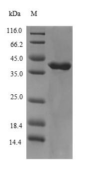 Human Muscarinic acetylcholine receptor M3 (CHRM3), partial Recombinant Protein, N-His-B2M, Homo sapiens (Human), E.coli, N-terminal 6xHis-B2M-tagged, 40.7 kDa, purity >≥ 90% as determined by SDS-PAGE.