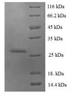 Human Protein S100-A6 (S100A6) Recombinant Protein - BioCrest Sci