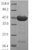 Human Serine/threonine-protein kinase 32A (STK32A) Recombinant Protein - BioCrest Sci