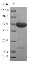 Human Serine/threonine-protein kinase 32A (STK32A) Recombinant Protein, Homo sapiens (Human), E.coli, N-terminal GST-tagged, 46.8 kDa, purity >≥ 90% as determined by SDS-PAGE.
