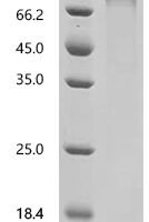 Human UDP-N-acetylglucosamine--peptide N-acetylglucosaminyltransferase 110 kDa subunit (OGT) Recombinant Protein - BioCrest Sci