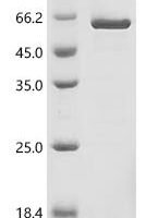 Human Aldo-keto reductase family 1 member B10 (AKR1B10) (K125L) Recombinant Protein - BioCrest Sci