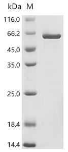 Human Aldo-keto reductase family 1 member B10 (AKR1B10) (K125L) Recombinant Protein, Homo sapiens (Human), E.coli, N-terminal GST-tagged, 62.7 kDa, purity >≥ 90% as determined by SDS-PAGE.