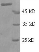 Human Zinc finger protein 384 (ZNF384), partial Recombinant Protein - BioCrest Sci