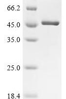 Human papillomavirus type 16 Regulatory protein E2(E2) Recombinant Protein - BioCrest Sci