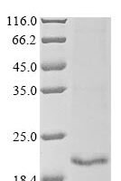 Rickettsia rickettsii 17 kDa surface antigen (omp) Recombinant Protein - BioCrest Sci