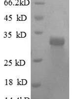 Human Laminin subunit beta-2 (LAMB2), partial Recombinant Protein - BioCrest Sci