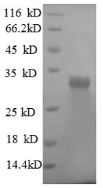 Human Laminin subunit beta-2 (LAMB2), partial Recombinant Protein, Homo sapiens (Human), E.coli, N-terminal 6xHis-tagged, 33.3 kDa, purity >≥ 90% as determined by SDS-PAGE.