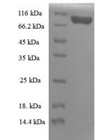Mouse Importin subunit beta-1 (Kpnb1) Recombinant Protein - BioCrest Sci