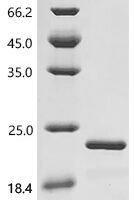 Human Transcription factor SOX-11 (SOX11), partial Recombinant Protein - BioCrest Sci