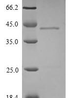 Mouse Hepatoma-derived growth factor (Hdgf) Recombinant Protein - BioCrest Sci