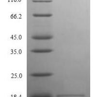 Human Angiogenin (ANG), partial Recombinant Protein - BioCrest Sci