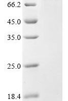 Human TNFAIP3-interacting protein 1 (TNIP1) Recombinant Protein - BioCrest Sci