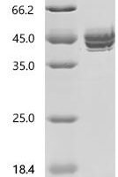 Pig Advanced glycosylation end product-specific receptor precursor (AGER), partial Recombinant Protein - BioCrest Sci