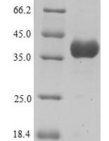 Human Annexin A3 (ANXA3), partial Recombinant Protein, N-His, aa 5–322, Yeast - BioCrest Sci