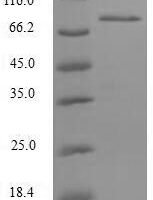 Human NF-kappa-B-repressing factor (NKRF), partial Recombinant Protein - BioCrest Sci