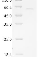 Human Sarcoplasmic/endoplasmic reticulum calcium ATPase 2 (ATP2A2), partial Recombinant Protein, C-His - BioCrest Sci