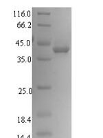 Human Signal-regulatory protein gamma (SIRPG), partial Recombinant Protein, N-His, aa 29–360, E.coli - BioCrest Sci