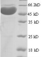 Human Protein arginine N-methyltransferase 1 (PRMT1), partial Recombinant Protein, N-GST - BioCrest Sci