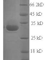 Staphylococcus aureus Exfoliative toxin A (eta) Recombinant Protein - BioCrest Sci