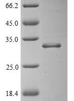 Human Oligodendrocyte transcription factor 1 (OLIG1), partial Recombinant Protein - BioCrest Sci