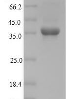 Mouse Homeobox protein Nkx-3.2 (Nkx3-2) Recombinant Protein, Tag-Free - BioCrest Sci