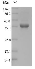 Mouse Homeobox protein Nkx-3.2 (Nkx3-2) Recombinant Protein, Tag-Free, Mus musculus (Mouse), E.coli, Tag-Free, 35.2 kDa, purity >≥ 90% as determined by SDS-PAGE.