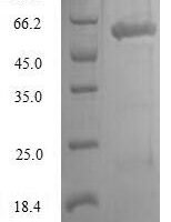 Human Lymphocyte-specific protein 1 (LSP1) Recombinant Protein - BioCrest Sci