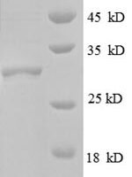 Escherichia coli 50S ribosomal protein L30 (rpmD) Recombinant Protein, N-GST - BioCrest Sci