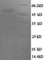 Human Serine/arginine-rich splicing factor 9 (SRSF9) Recombinant Protein, N-GST - BioCrest Sci