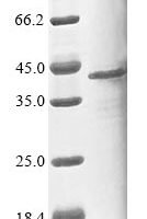 Human Pleckstrin homology domain-containing family F member 1 (PLEKHF1) Recombinant Protein - BioCrest Sci