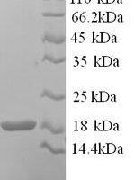 Mouse Hemoglobin subunit alpha (Hba) Recombinant Protein, N-His - BioCrest Sci