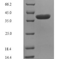 Lithobates catesbeiana Saxiphilin, partial Recombinant Protein, C-9xHis - BioCrest Sci
