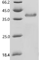 Human Serine protease inhibitor Kazal-type 1 (SPINK1), partial Recombinant Protein - BioCrest Sci
