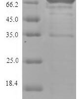 Human Lysyl oxidase homolog 4 (LOXL4) Recombinant Protein, N-His - BioCrest Sci