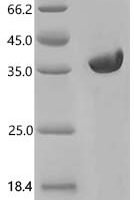 Saccharomyces cerevisiae High mobility group protein 1 (HMO1) Recombinant Protein - BioCrest Sci