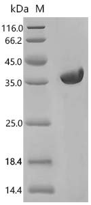 Saccharomyces cerevisiae High mobility group protein 1 (HMO1) Recombinant Protein, Saccharomyces cerevisiae (strain ATCC 204508 / S288c) (Baker's yeast), E.coli, C-terminal 6xHis-tagged, 34.5 kDa, purity >≥ 85% as determined by SDS-PAGE.