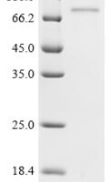 Human CCNA2&CDK2 Heterodimer Protein Recombinant Protein - BioCrest Sci