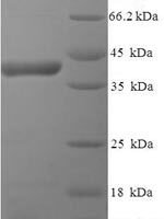 Human respiratory syncytial virus A Major surface glycoprotein G (G), partial Recombinant Protein, N-His-SUMO - BioCrest Sci