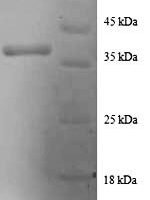 Human Death-associated protein 1 (DAP) Recombinant Protein - BioCrest Sci