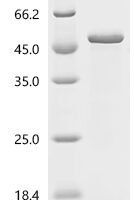 Measles virus Nucleoprotein(N), partial Recombinant Protein, C-10His - BioCrest Sci