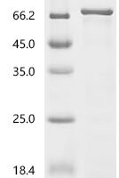 Mouse Heat shock 70 kDa protein 1-like (Hspa1l) Recombinant Protein, C-His - BioCrest Sci