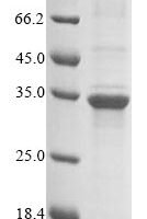 Mouse Troponin I, slow skeletal muscle (Tnni1) Recombinant Protein, N-10His-Flag/C-Myc - BioCrest Sci