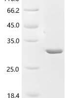 Newcastle disease virus RNA-directed RNA polymerase L (L), partial Recombinant Protein, N-10His/C-Myc - BioCrest Sci