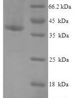 Human Death domain-containing protein CRADD (CRADD) Recombinant Protein - BioCrest Sci